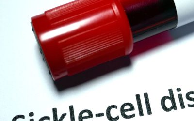 Understanding Sickle Cell Disease: What You Need to Know